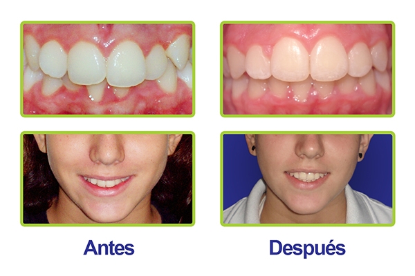 ortodoncia_3